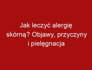 Jak leczyć alergię skórną? Objawy, przyczyny i pielęgnacja
